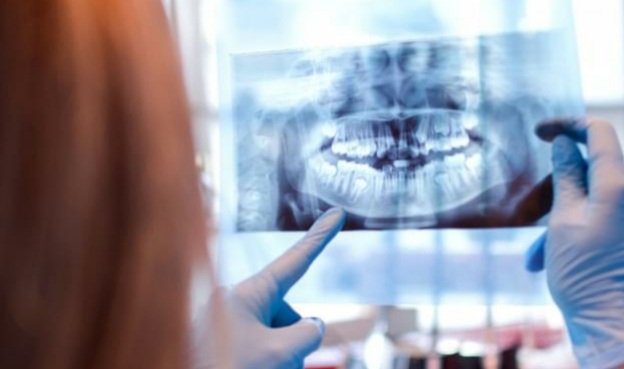 Forensic dentists helping ID human remains in RCMP investigations
