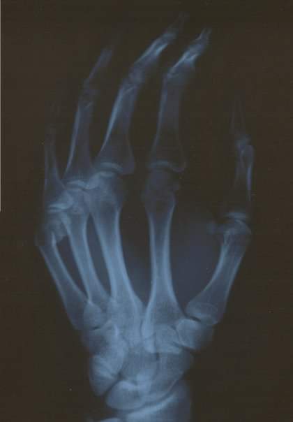Nova Scotians will soon be able to access more information about their X-ray results through the YourHealthNS app